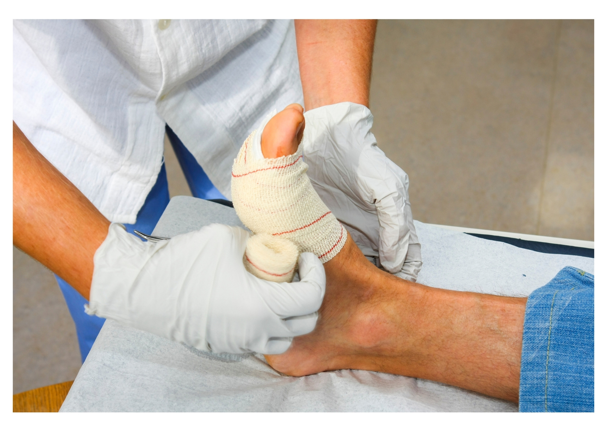Comprehensive Treatment for Wounds Applying wound care dressings